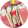 Ramo da odontologia responsável pelo tratamento dos canais dos dentes.